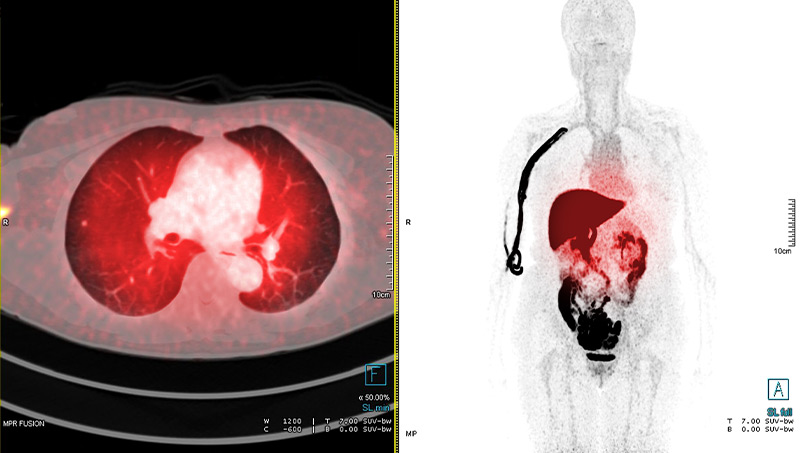 PET/CT Scan of organs at Halo Body Scan in Oklahoma