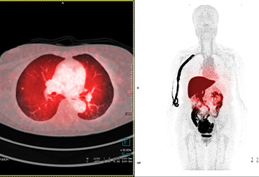 PET/CT Scan of organs at Halo Body Scan in Oklahoma