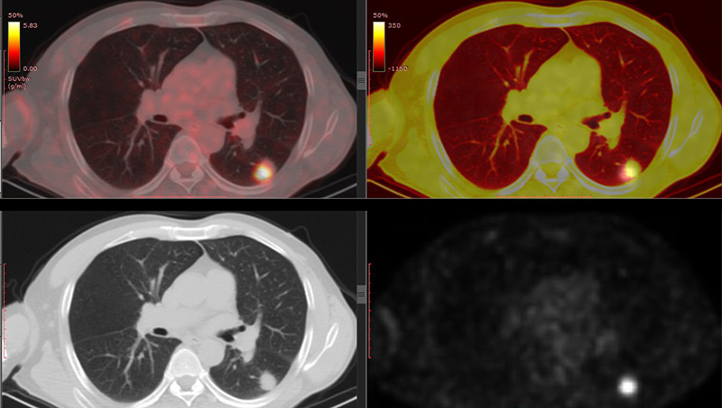 MRI vs CT vs PET vs X-Ray at Halo Body Scan in Oklahoma