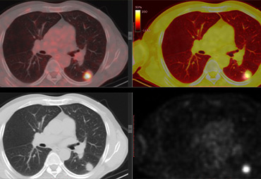 MRI vs CT vs PET vs X-Ray at Halo Body Scan in Oklahoma