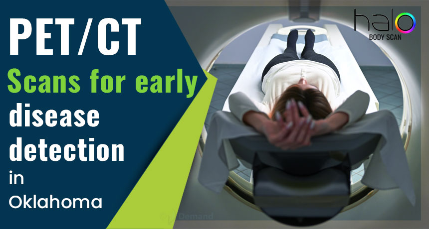 PET/CT scans for early disease detection in Oklahoma City