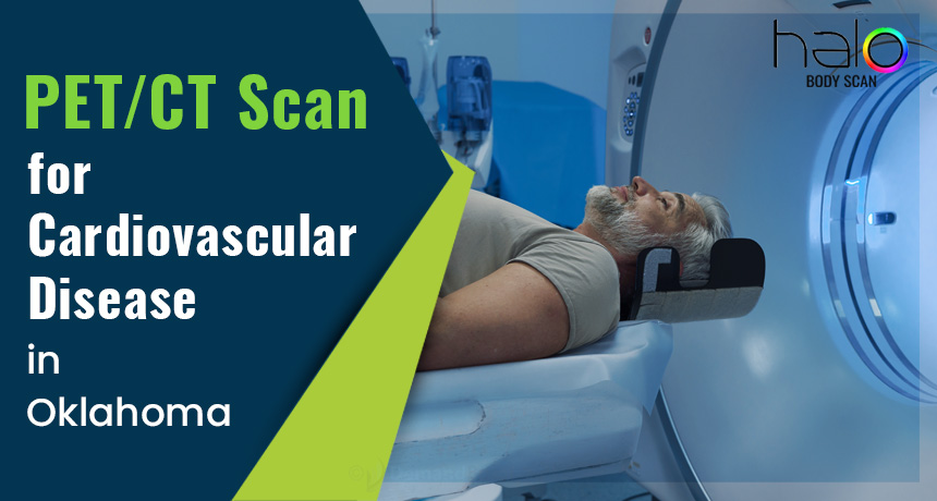 PET/CT Scans for Cardiovascular Disease in Oklahoma City
