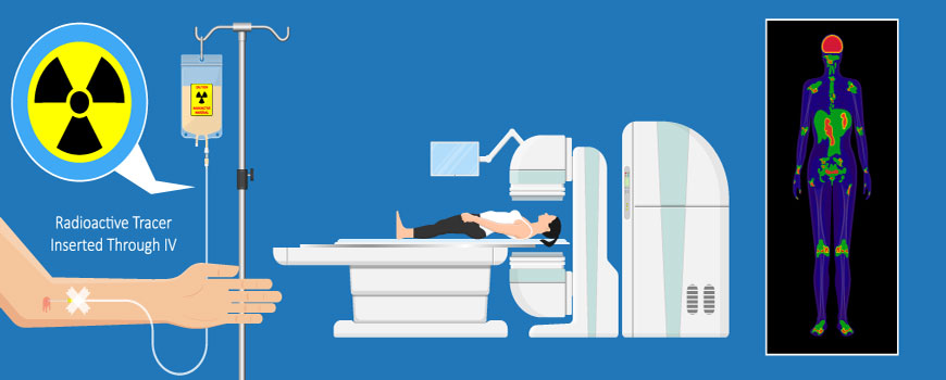 PET/CT Scan technology in Oklahoma